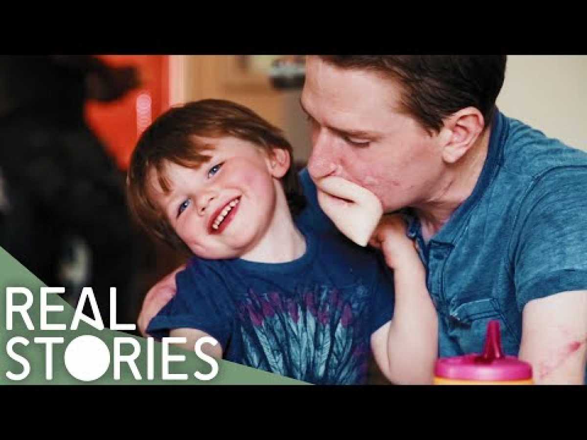 How Did Alex Lewis&#039; Family Cope With His Illness? | Real Stories